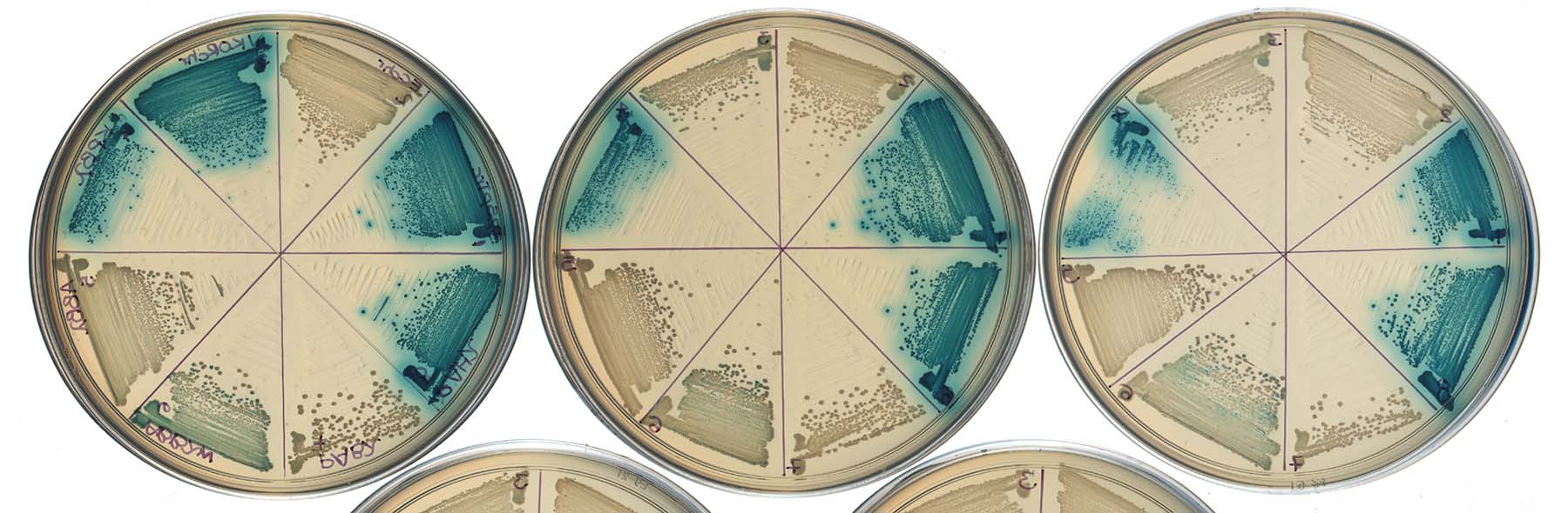 Xgal plate with bacteria